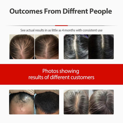 Red Light Therapy Cap for Hair Growth – 650nm LED