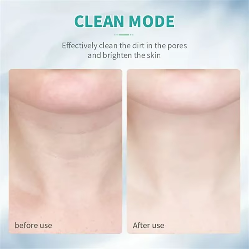 Face Neck Tool for Skin Care, Electric Neck Face Lifting Device for Wrinkle Removal